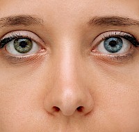 Heterochromia: A Fascinating Eye Color Mutation